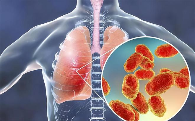 新冠肺炎患者最新论述及解析