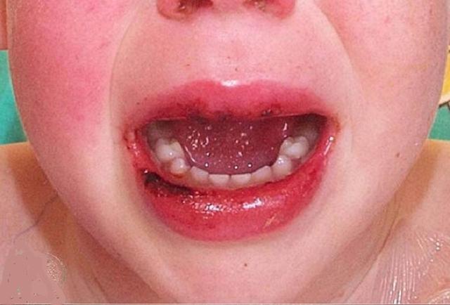 最新肺炎疫情病例数、影响及观点阐述,疫情现状与趋势分析