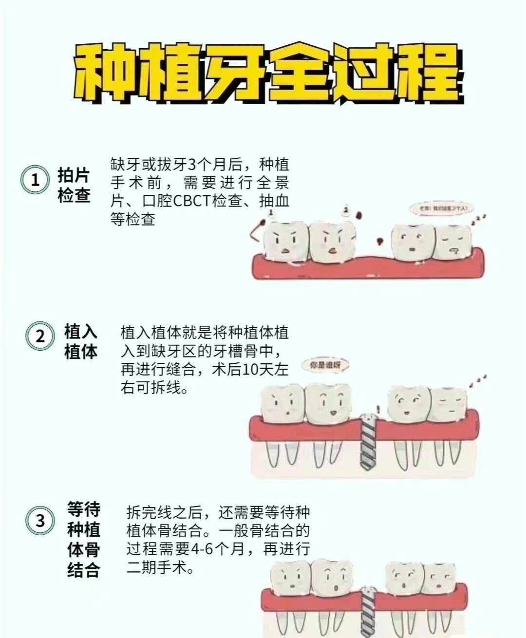 最新种植牙技术重塑灿烂微笑