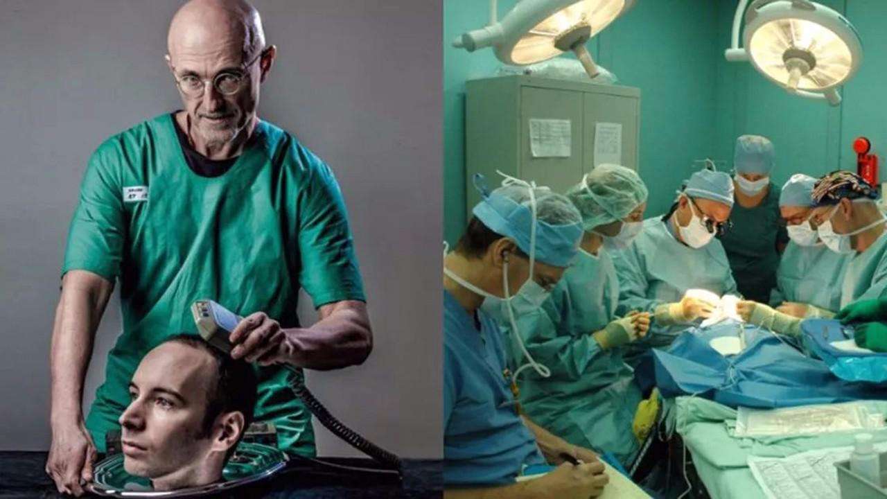 换头手术最新进展,重塑生命的奇迹与挑战探索之路